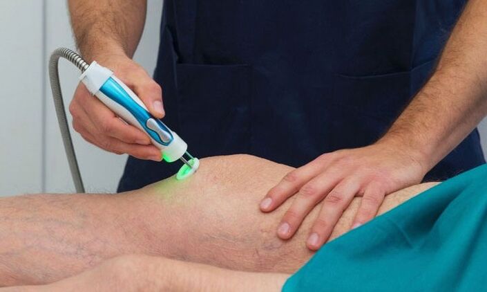 termografía de la articulación de la rodilla con artrosis
